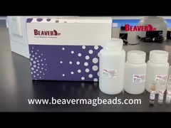BeaverBeads Stool RNA Kit Extract Nucleic Acid Excellent Stability